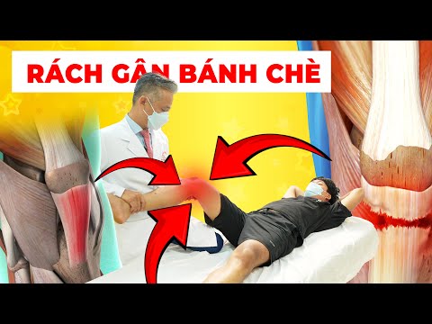 Bạn Đã Chịu Cơn Đau Gối Kéo Dài 1 Năm? Khám Phá Cách Điều Trị Hiệu Quả