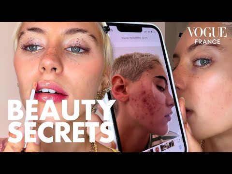 Iris Law's Step-By-Step Guide to Acne Skincare | Vogue...