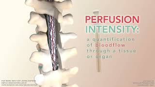 Tissue Perfusion