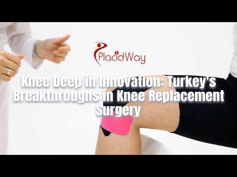 Revolutionizing Mobility: Knee Replacement Surgery in Turkey Innovation