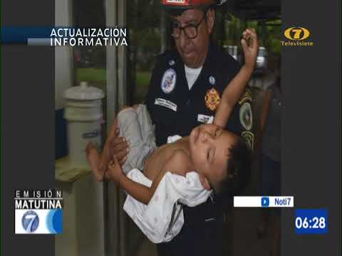 Niño fue atacado por un perro en San Marcos