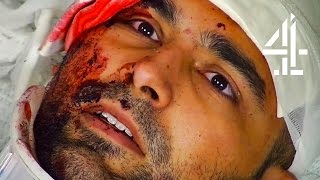 Twin Brother Loses Memory In Accident | 24 Hours In A&E video