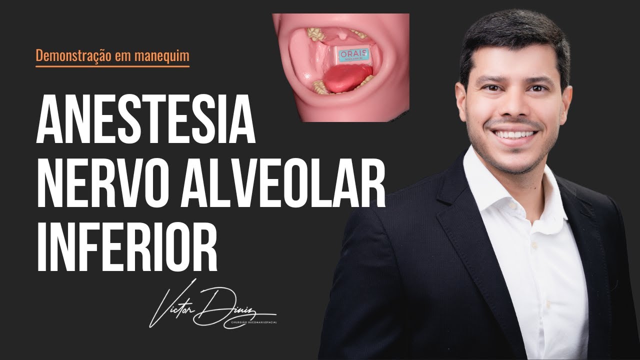 Anestesia do nervo alveolar inferior - demonstração em manequim