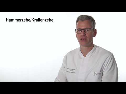 Fuß -  Hammerzehe Krallenzehe, Prof. Dr. Thomas Kälicke, GFO Kliniken Bonn
