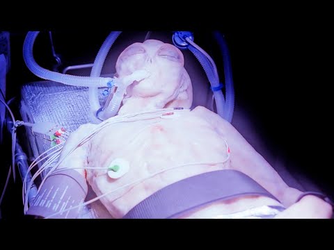 The X Files Season 4 Part 1 |Military's Test On Human-Alien Hybrids