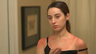 Newswise:Video Embedded how-to-prevent-and-treat-common-summer-rashes