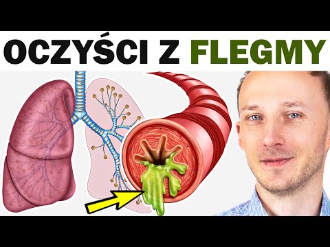 Zalegająca flegma w gardle i chrząkanie. Jak ją usunąć?