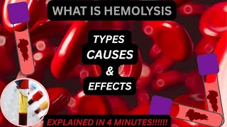 Hemolysis Explained | Hemolysis In Blood Samples|#hemoglobin #laboratory