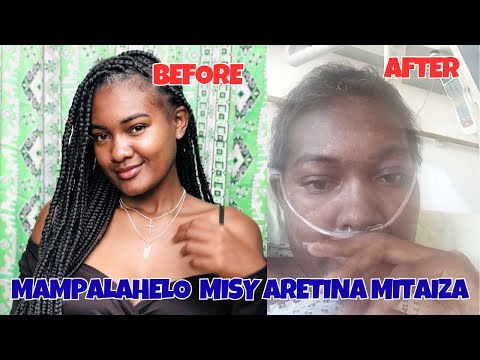 LOZA -AREITINA MITAIZA MAMPALAHELO