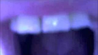 White Dreams Rapid Eye Movement Sequence