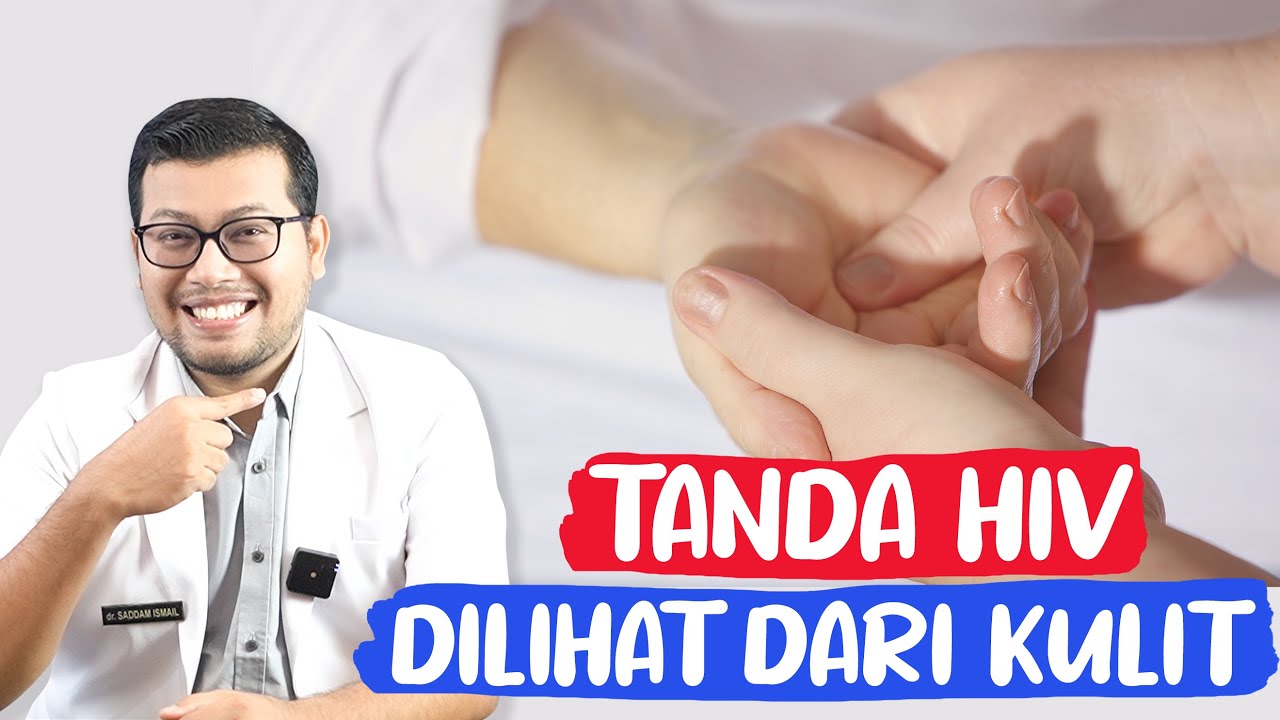 CIRI CIRI HIV YANG TERLIHAT DIKULIT - DOKTER SADDAM ISMAIL
