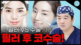 필러하면 되지 않냐고요?당연히 다르죠~ 코필러와 코수술의 차이!