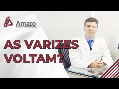 Varizes voltam? Elas saem de vez quando trata ou podem voltar?