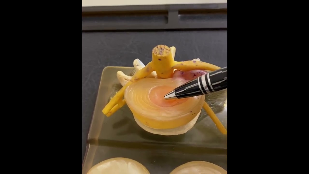 Mateus Tomaz Augusto-20