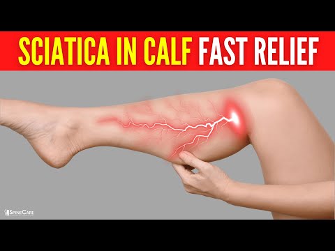 How to Instantly Relieve Sciatica Pain in the Calf