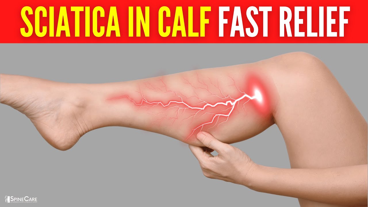 How to Instantly Relieve Sciatica Pain in the Calf