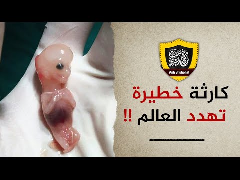 تقدمٌ حضاري ... وتخلُّفٌ ثقافي ...