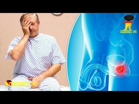 Das Wesen der Operation Entfernung der Prostata-Adenom Kräuter- und Prostatitis