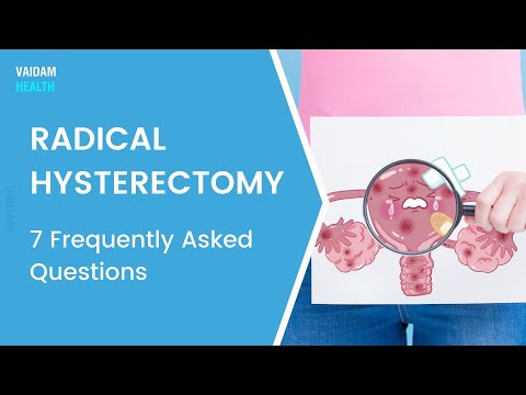 Radical Hysterectomy-7 Frequently Asked Questions