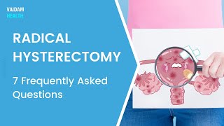 Radical Hysterectomy-7 Frequently Asked Questions