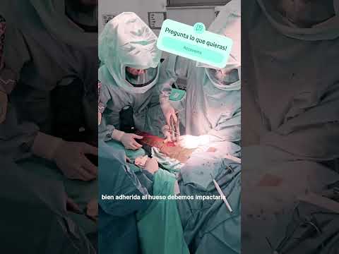 Jose Antonio Cordero Zirotti-8