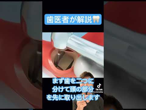 両歯歯症について詳しく解説