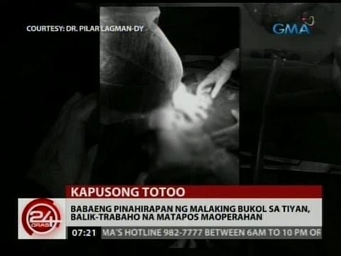 Bakwit diyeta para sa pagbaba ng timbang na may yogurt doktor review Kumuha alisan ng cellulite at sagging balat sa paa