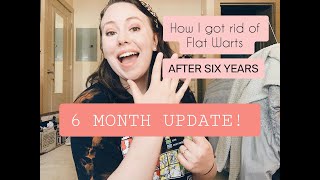 HOW TO GET RID OF FLAT WARTS  6 Month update!