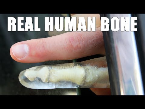 Can a Car Window Break Your Finger? Can a Car Window Break Your Finger?