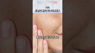 기미 치료에서 토닝만 반복하기 전 확인할 점