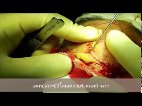 ครีม uvilichenie เต้านม ชุดว่ายน้ำ pushapom มีหน้าอกขนาดเล็ก