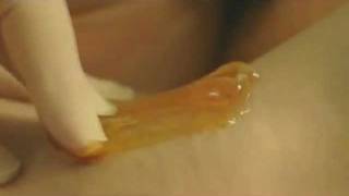 preview picture of video 'Haarentfernung Enthaarung sugaring waxing mit orientalischer Zuckerpaste - Hala Schekar'