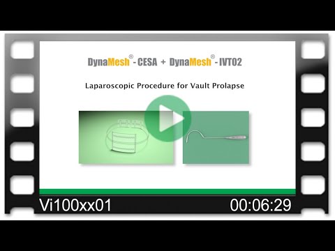 DynaMesh®-CESA-&-IVT02 Laparoscopy OR-Video: Cervicosacropexy - Dr. Weingärtler