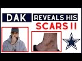 Dak Reveals his SCARS | Hard Knocks Highlights