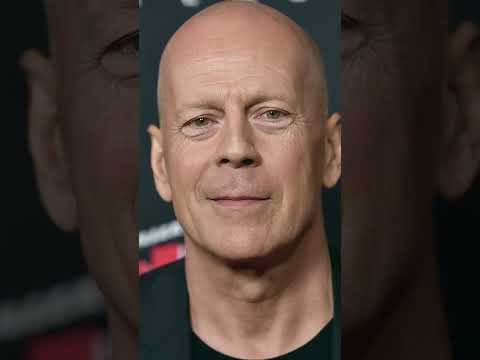 Can Your Finger Length Reveal If You’ll Go Bald? 😳 | Studio 10