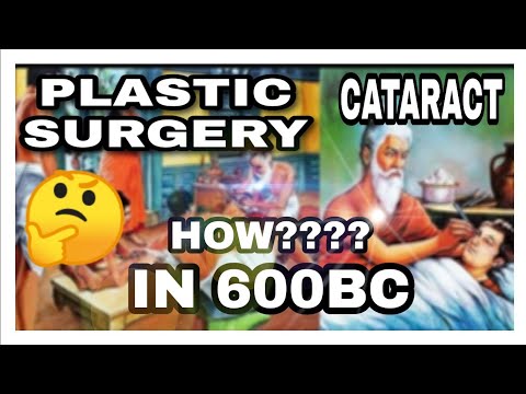 Plastic Surgery & Cataract In 6th BCE 🇮🇳 (Sushruta)