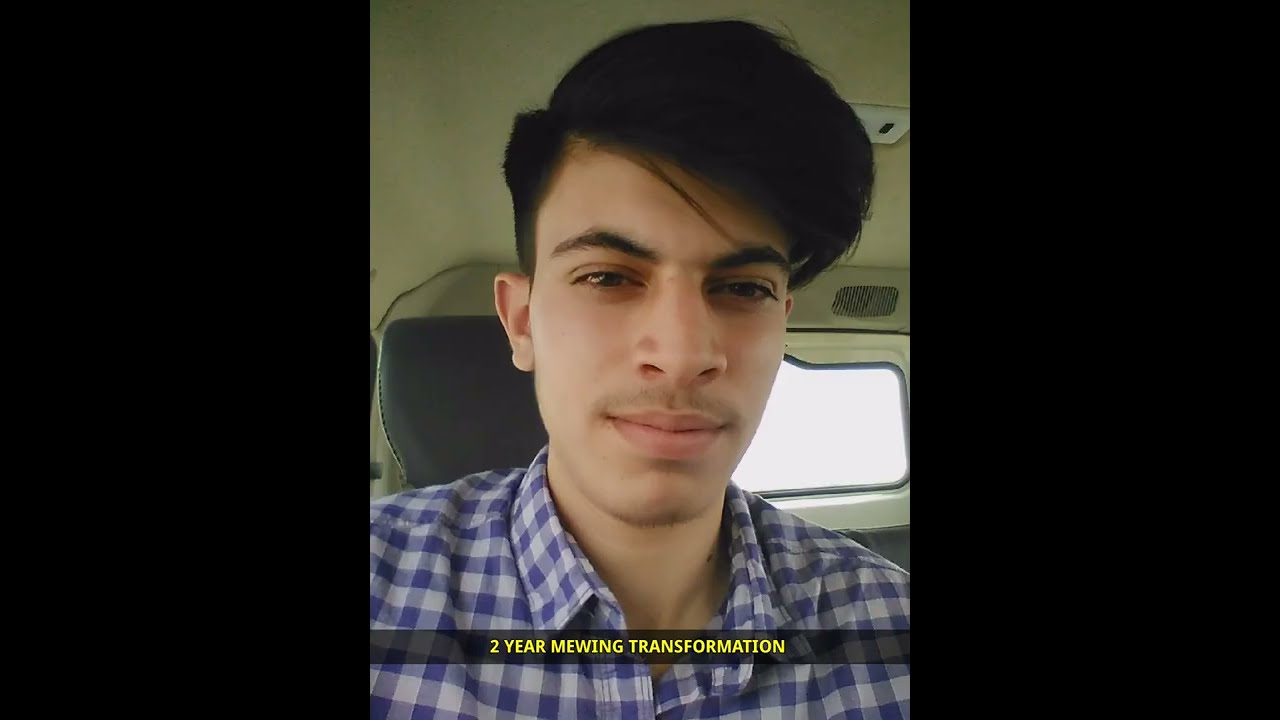 My 2 Years Mewing Transformation 20 Year Old Before And After Transformation  #viral #shorts #fyp