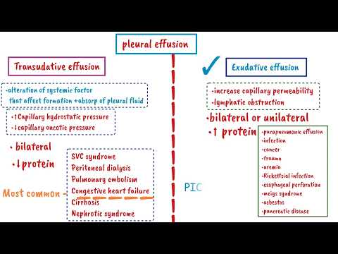Pleural Effusion | Exudative Effusion| Transudative Effusion | LIGHT'S CRITERIA