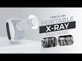 How To Use Portable Xray Machine Waldent V Light Pro DC X Ray Machine Dentalkart
