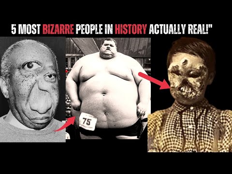 5 MOST Weird And UNBELIEVABLE People Explained in 11 Minutes