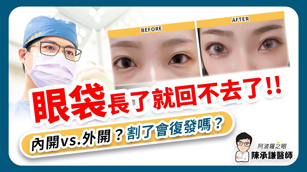 眼袋長出來是回不去的！眼袋手術要選內開或外開？割了還會復發嗎？| 陳承謙醫師