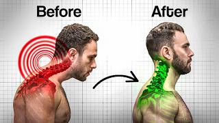 Neck Hump Not Going Away? Here's Why