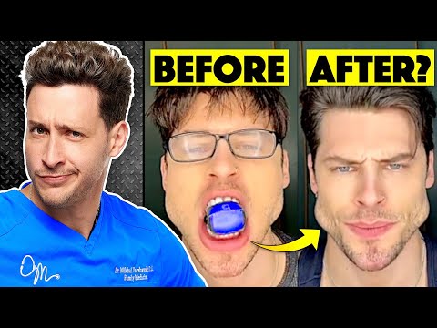 Do Jaw Trainers Actually Work? | Responding To Comments
