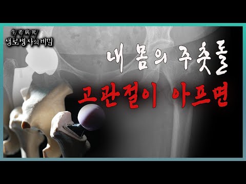 📌방송 하이라이트📌 고관절 뼈가 부러져서, 고관절에 병이 생겨서, 걷지 못하게 된 후에야 고관절의 중요성을 깨닫게 된 사람들을 만나본다 l KBS 20231115 방송