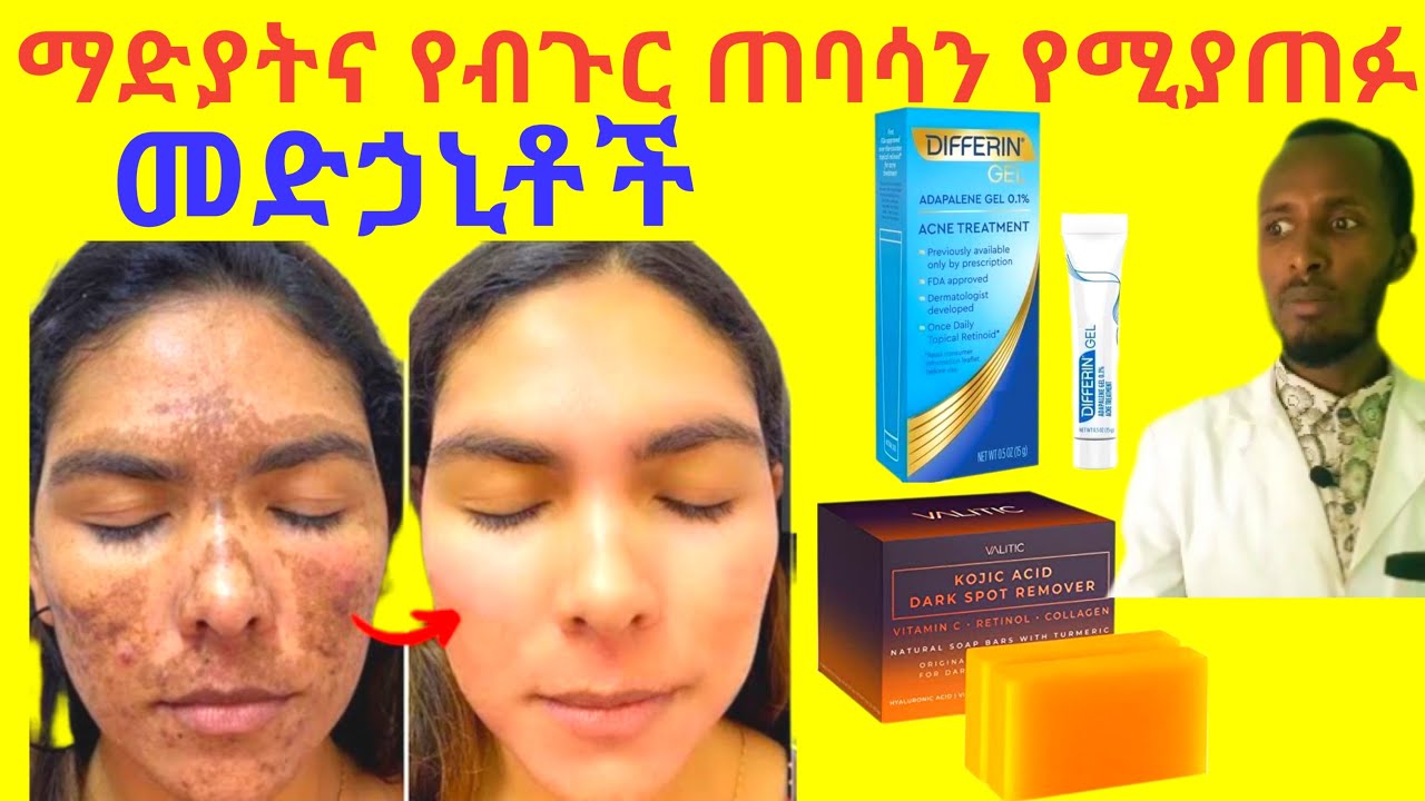 Best treatment for acne scars and hyperpigmentation FetanZena