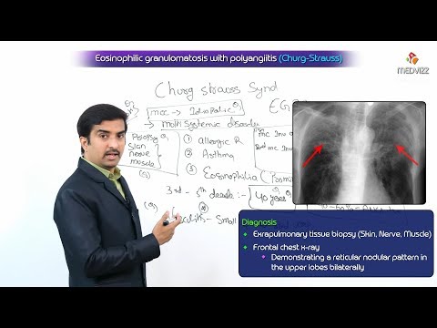 Eosinophilic granulomatosis with polyangiitis / Churg-Strauss Syndrome