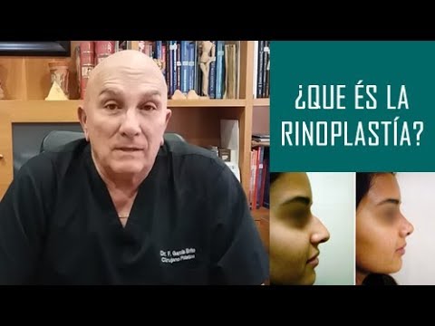 ¿Qué es la Rinoplastía?
