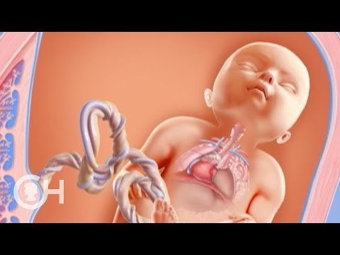 Fetoscopic endoluminal tracheal occlusion (FETO) | Children's Hospital of Philadelphia