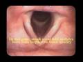 Vocal Folds Revealed