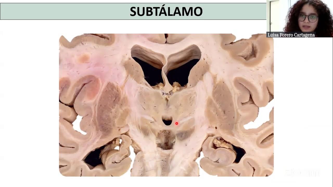 PARALELO DE ANATOMIA- TELENCEFALO + DIENCEFALO